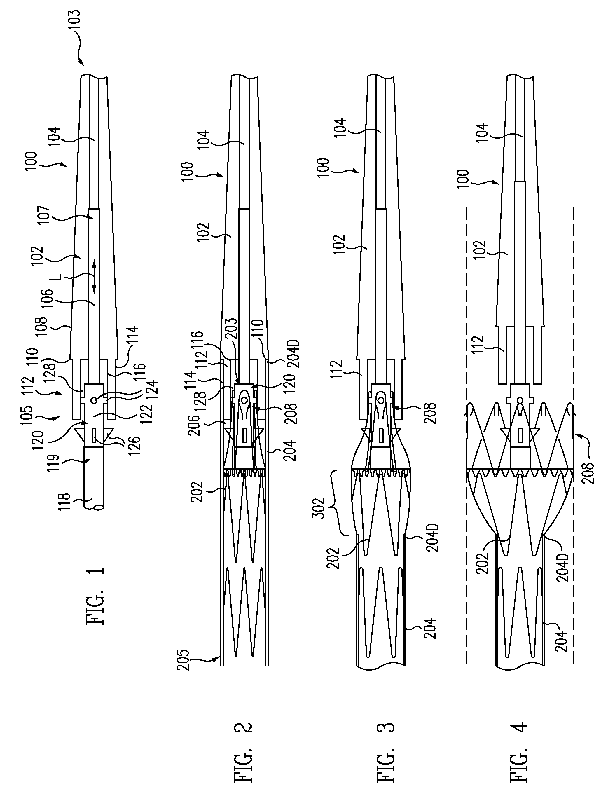 Stent-Graft With Anchoring Pins