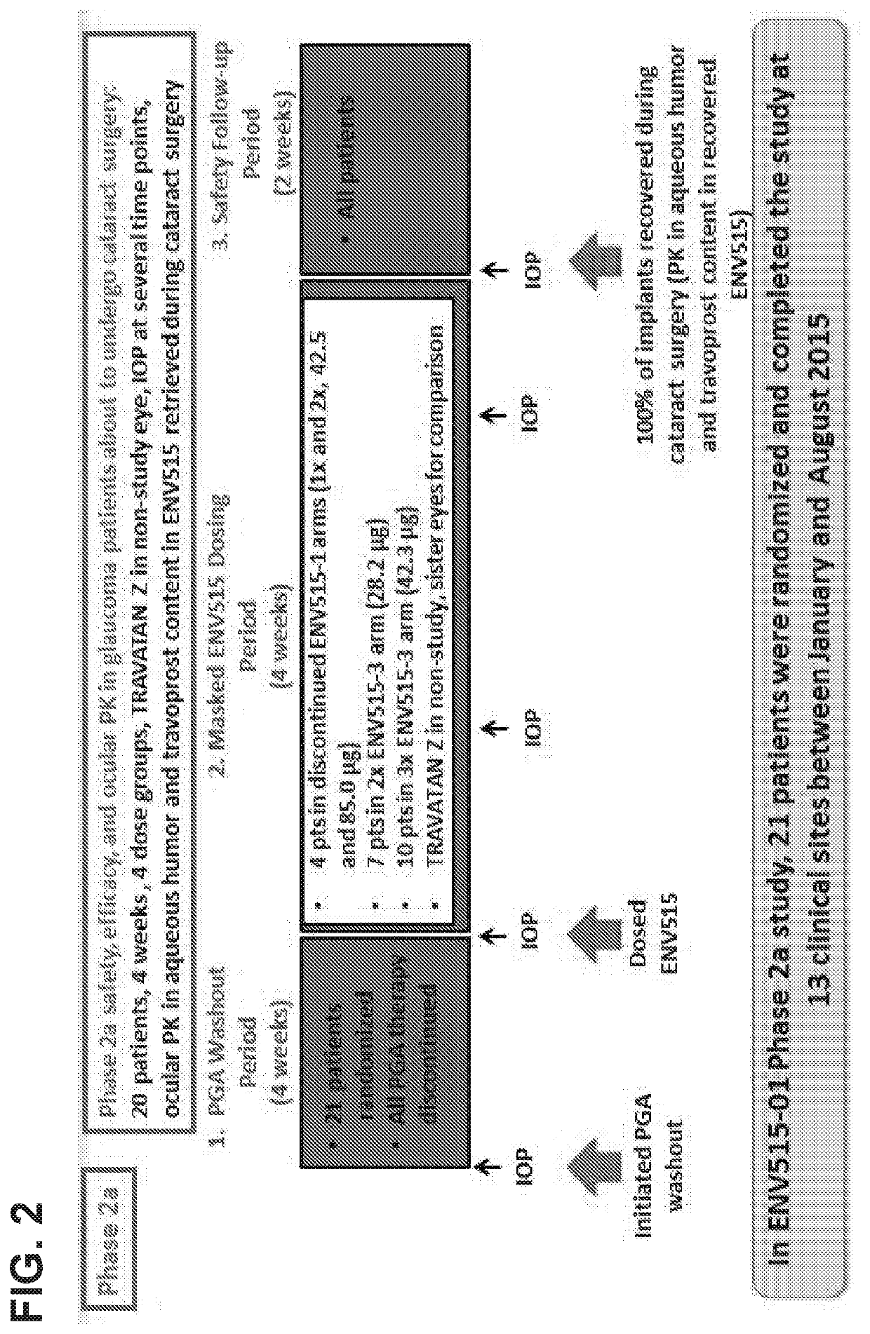 Glaucoma Treatment Via Intracameral Ocular Implants