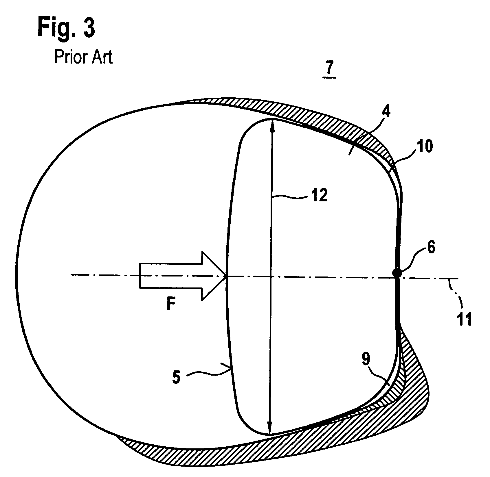 Plate-link chain, particularly for a motor vehicle drive system