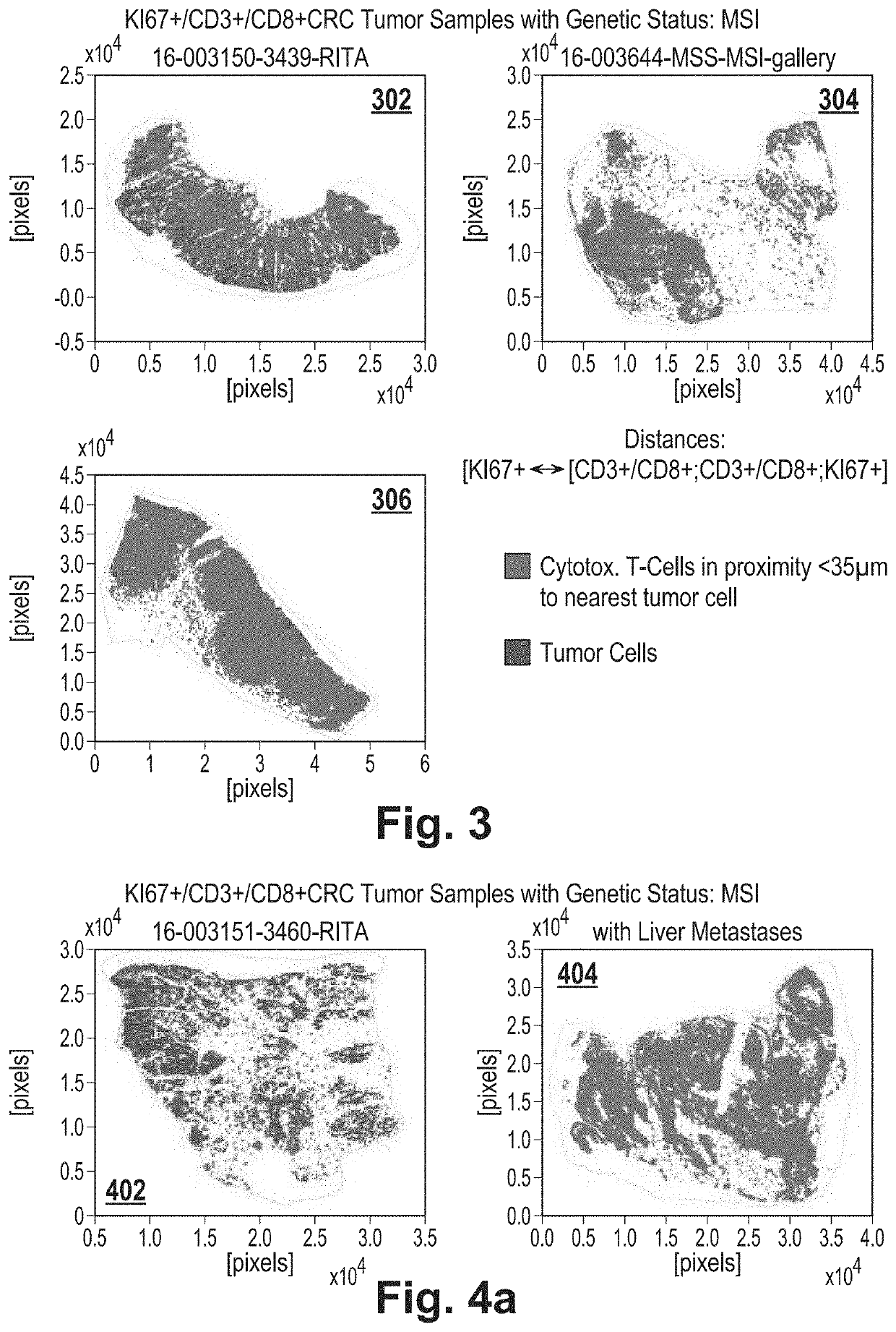 System and method of tumor classification