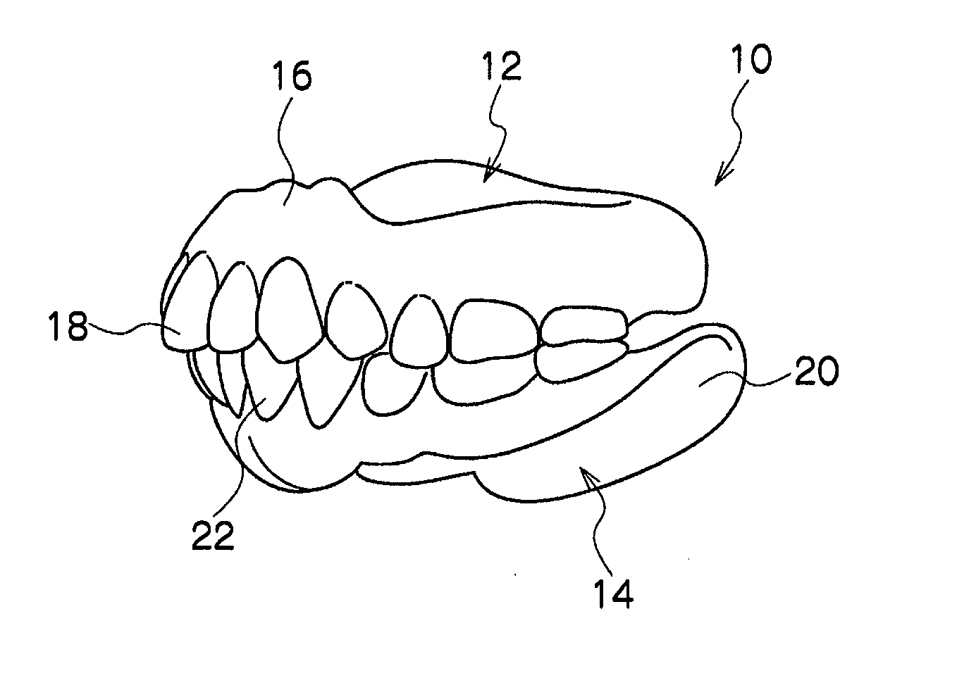 Removable denture and method of producing the same