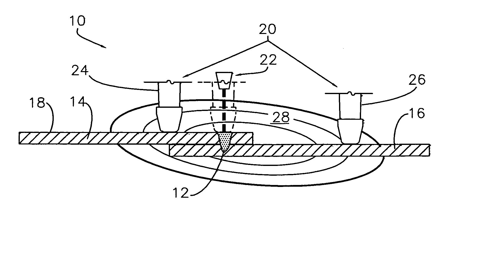 Hybrid laser and resistance welding system and method