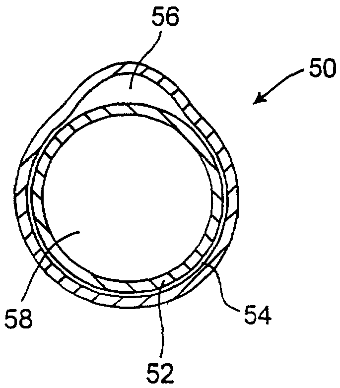 Methods, systems, and kits for lung volume reduction