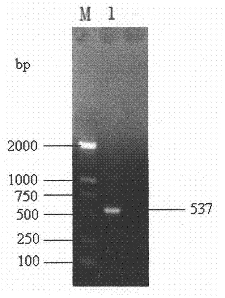 Species-specific primer pair for detecting glomus versiforme