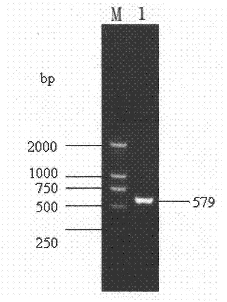 Species-specific primer pair for detecting glomus versiforme