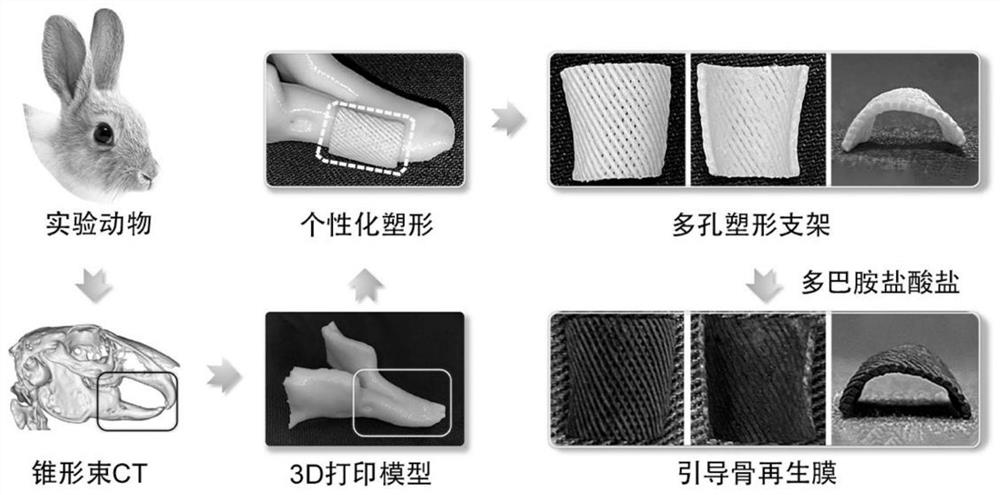 Preparation method of 3D printing moldable guided bone regeneration membrane