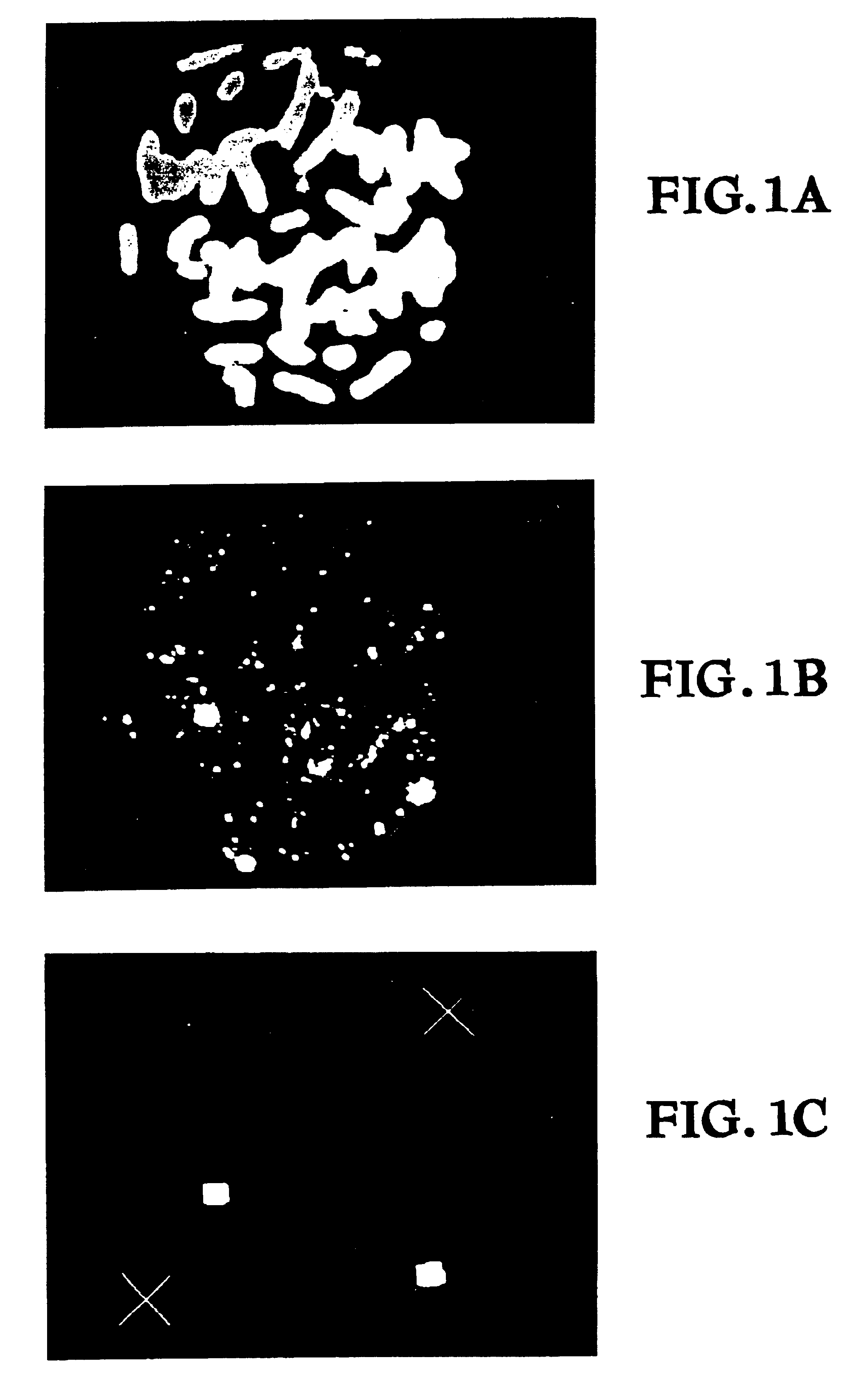 Method of staining target interphase chromosomal DNA