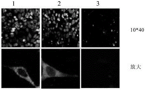 B cell antigen epitope polypeptide of infectious bronchitis virus isolate S1 protein, and vaccine thereof