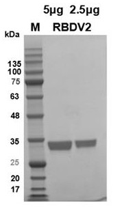 The rbd gene of the new coronavirus b.1.351 South African mutant strain and its application