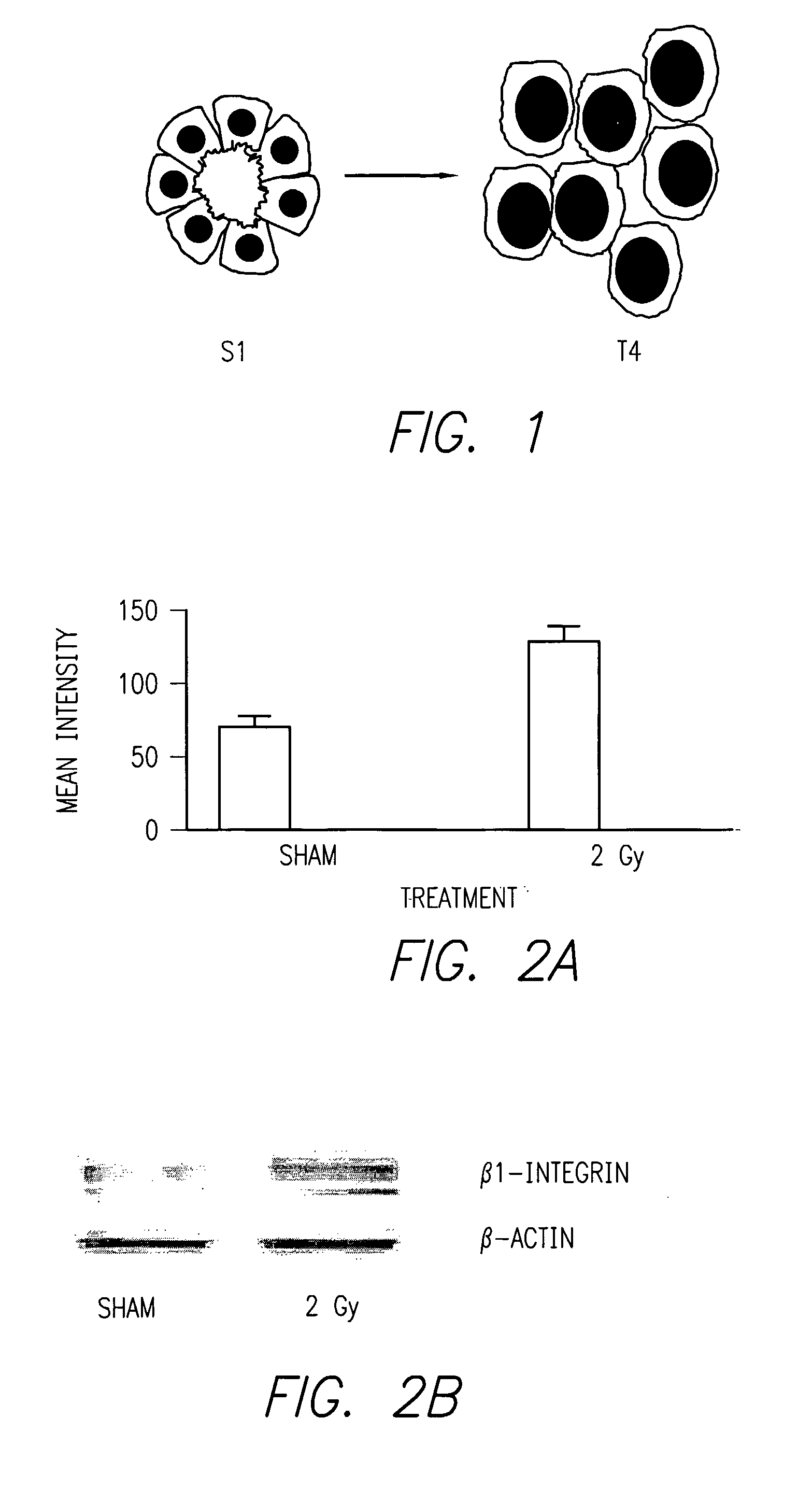 Method of Increasing Radiation Sensitivity by Inhibition of Beta One Integrin