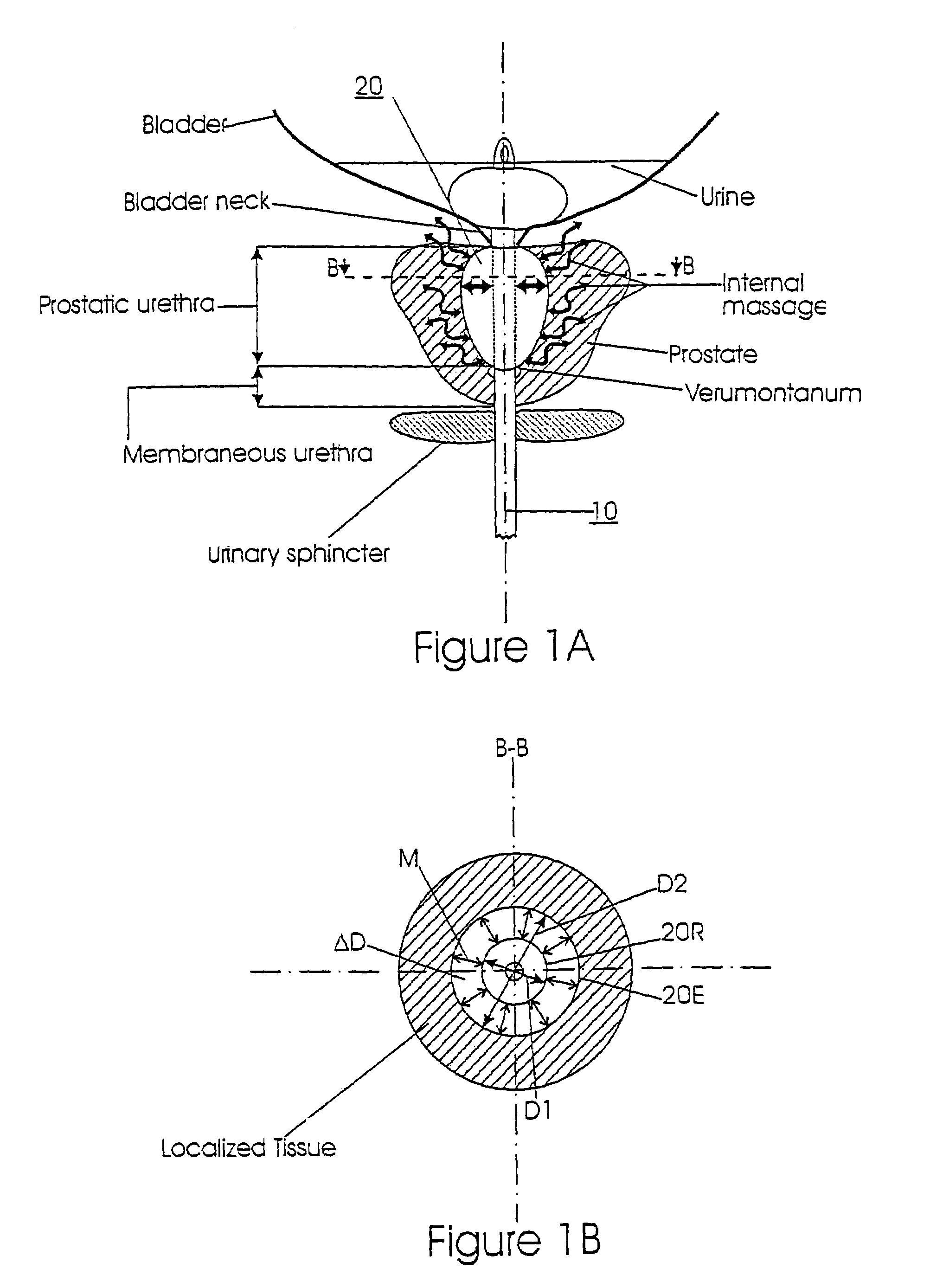 Methods for treating prostatitis