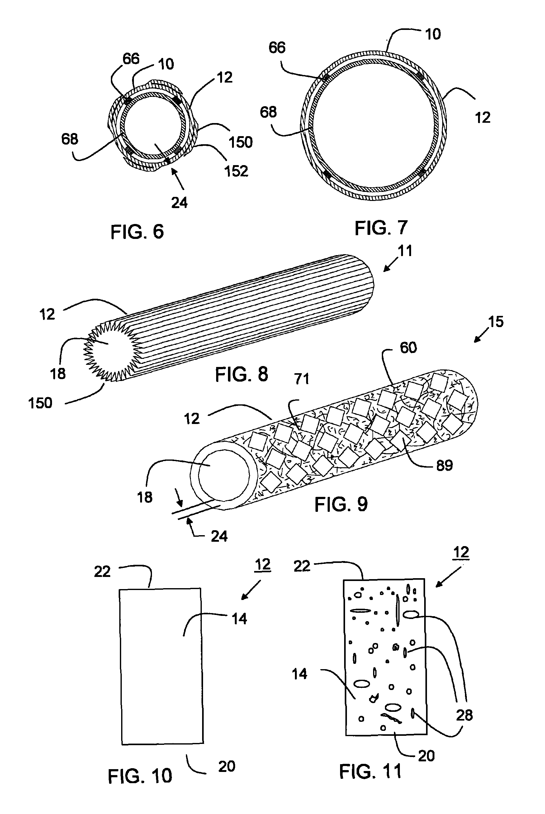 Fibrillated biodegradable prosthesis