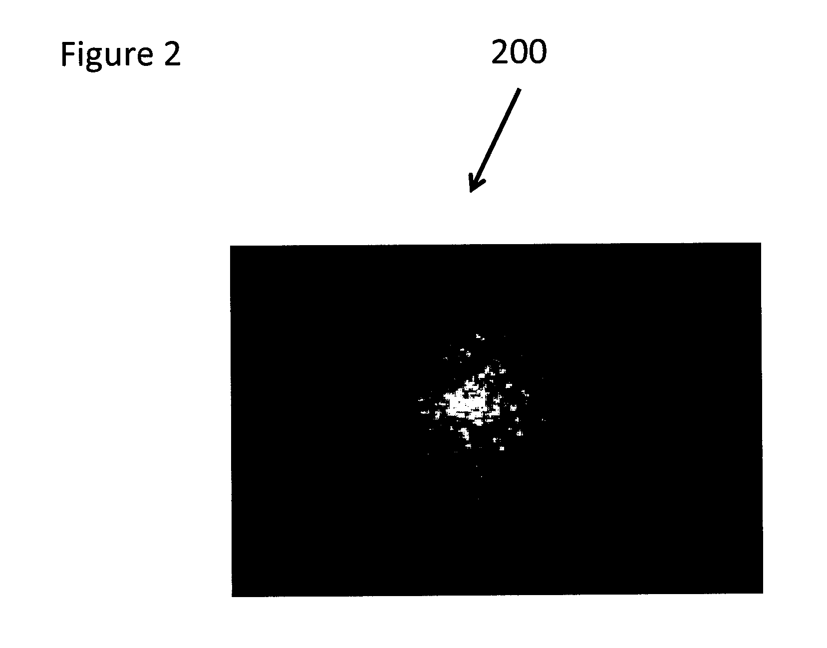 System and method for providing noninvasive diagnosis of compartment syndrome using exemplary laser speckle imaging procedure