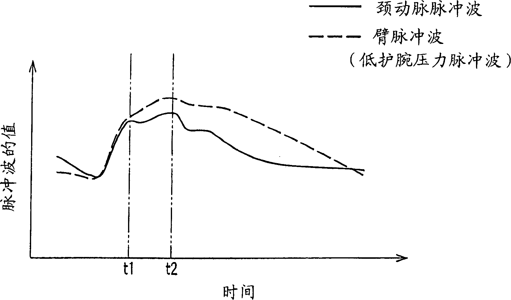 Increment index determining equipment and arteriosclerosis checking equipment