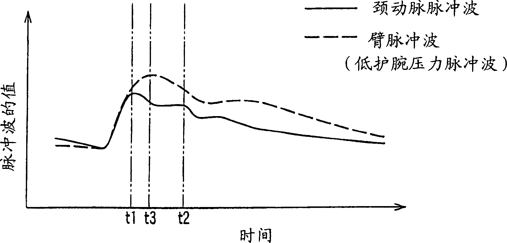 Increment index determining equipment and arteriosclerosis checking equipment