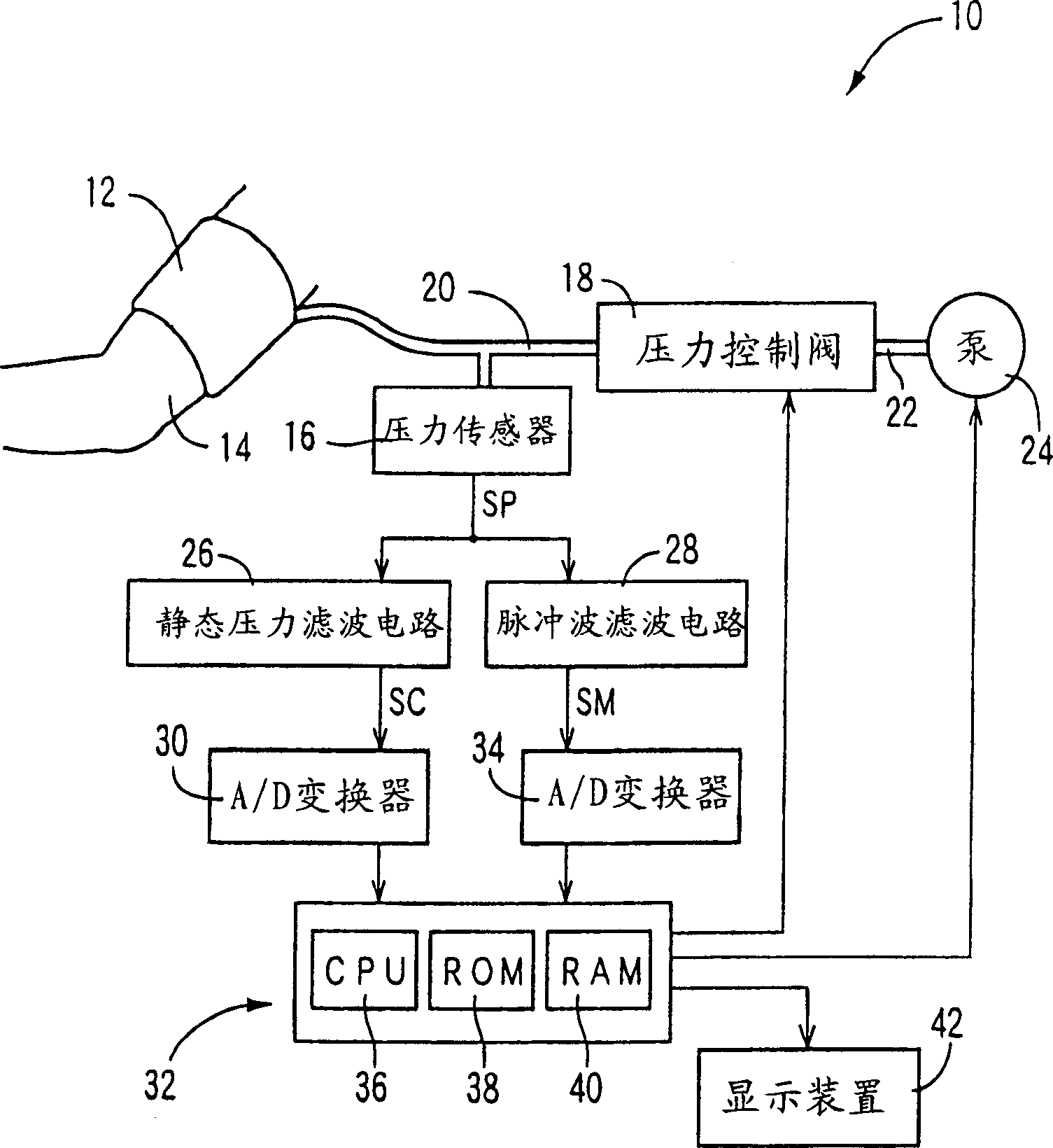 Increment index determining equipment and arteriosclerosis checking equipment