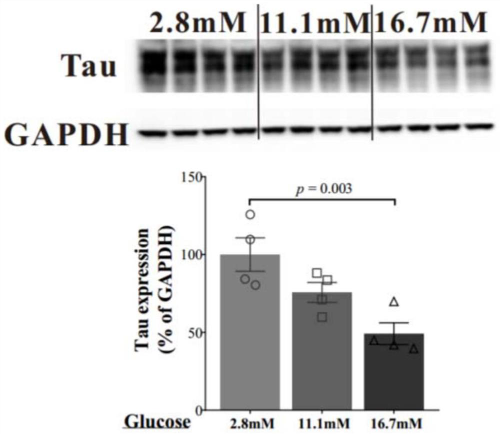 Application of tau protein and genes thereof as drug targets in preparation of drugs for treating diabetes mellitus