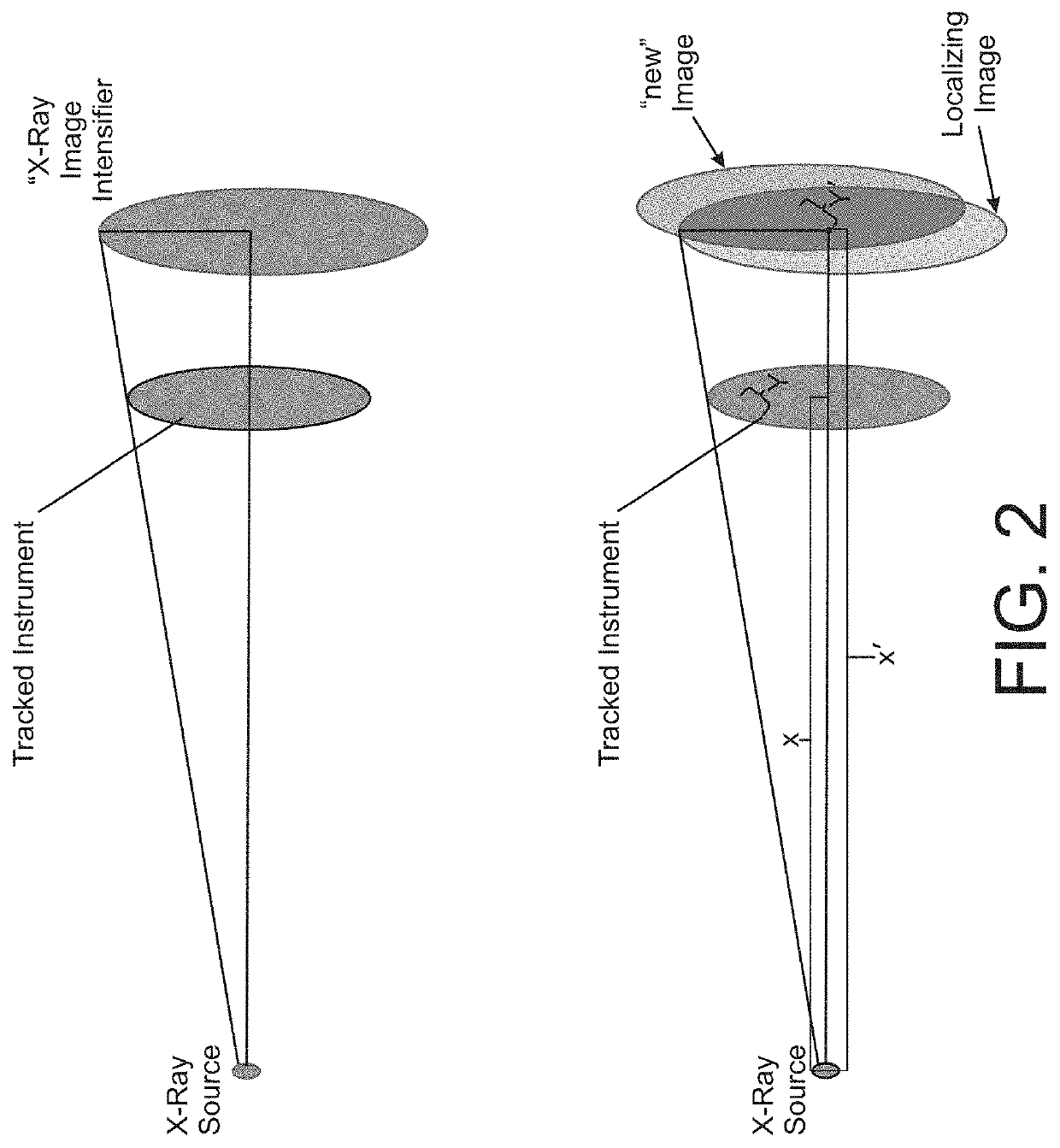 Imaging system and method for image localization of effecters during a medical procedure