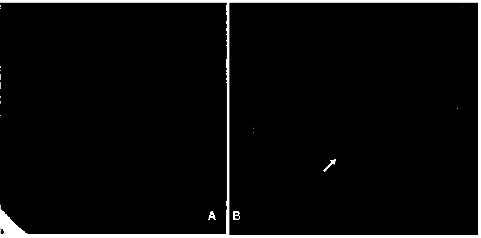 Kit for diagnosing cerebrovascular stenosis and application thereof