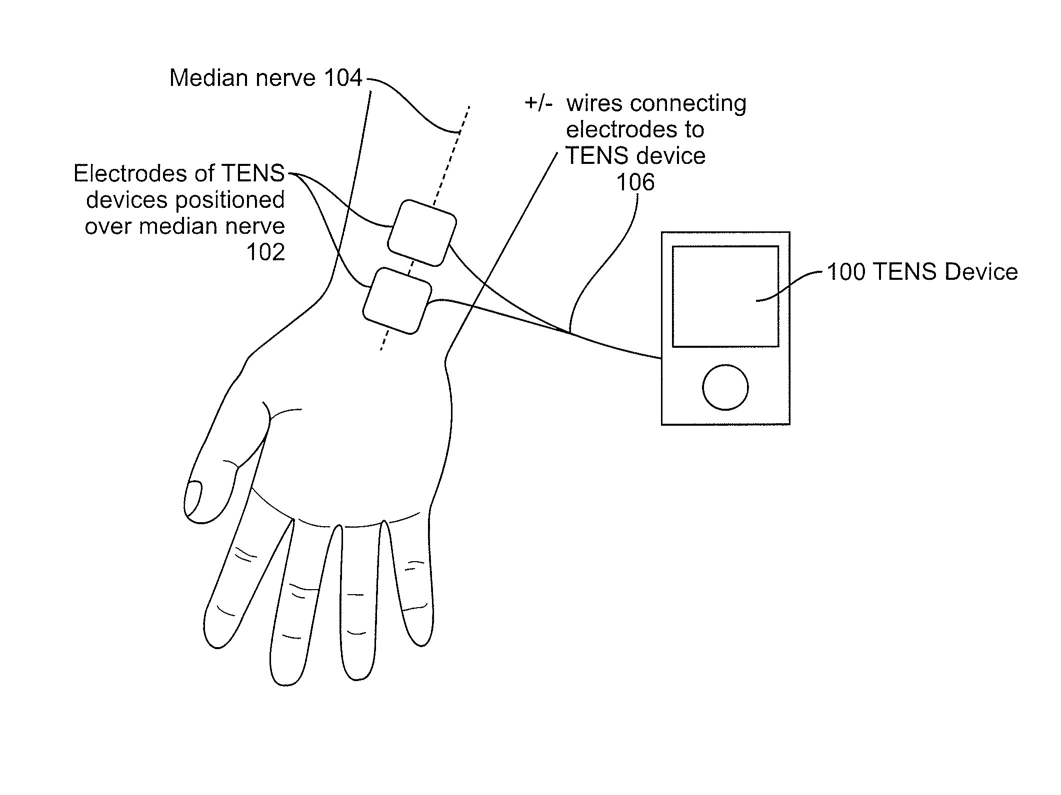 Devices and methods for controlling tremor