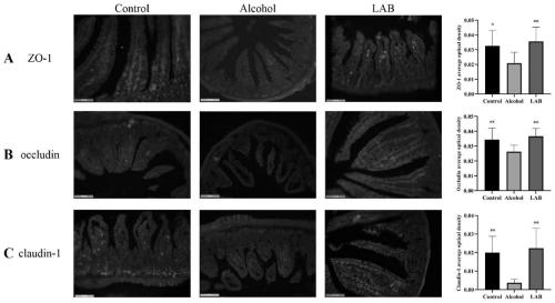 Lactic acid bacteria formula for preventing acute and chronic alcoholic liver injury and application thereof