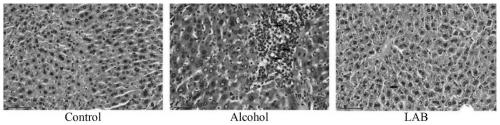 Lactic acid bacteria formula for preventing acute and chronic alcoholic liver injury and application thereof