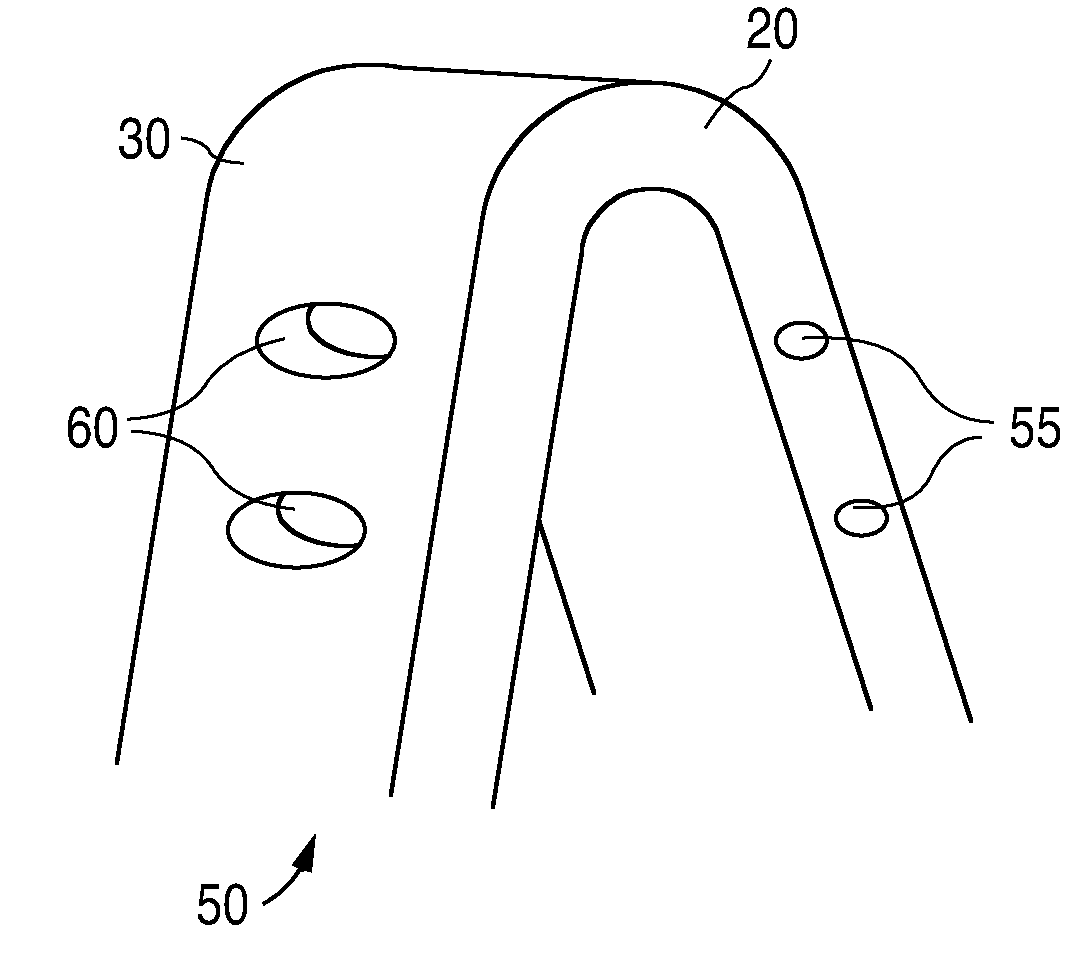 Anti-Proliferative And Anti-Inflammatory Agent Combination For Treatment Of Vascular Disorders With An Implantable Medical Device