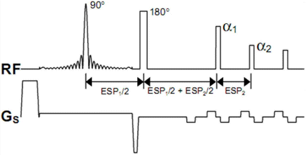 Brain, carotid artery and aorta three-in-one scanning method and scanning system