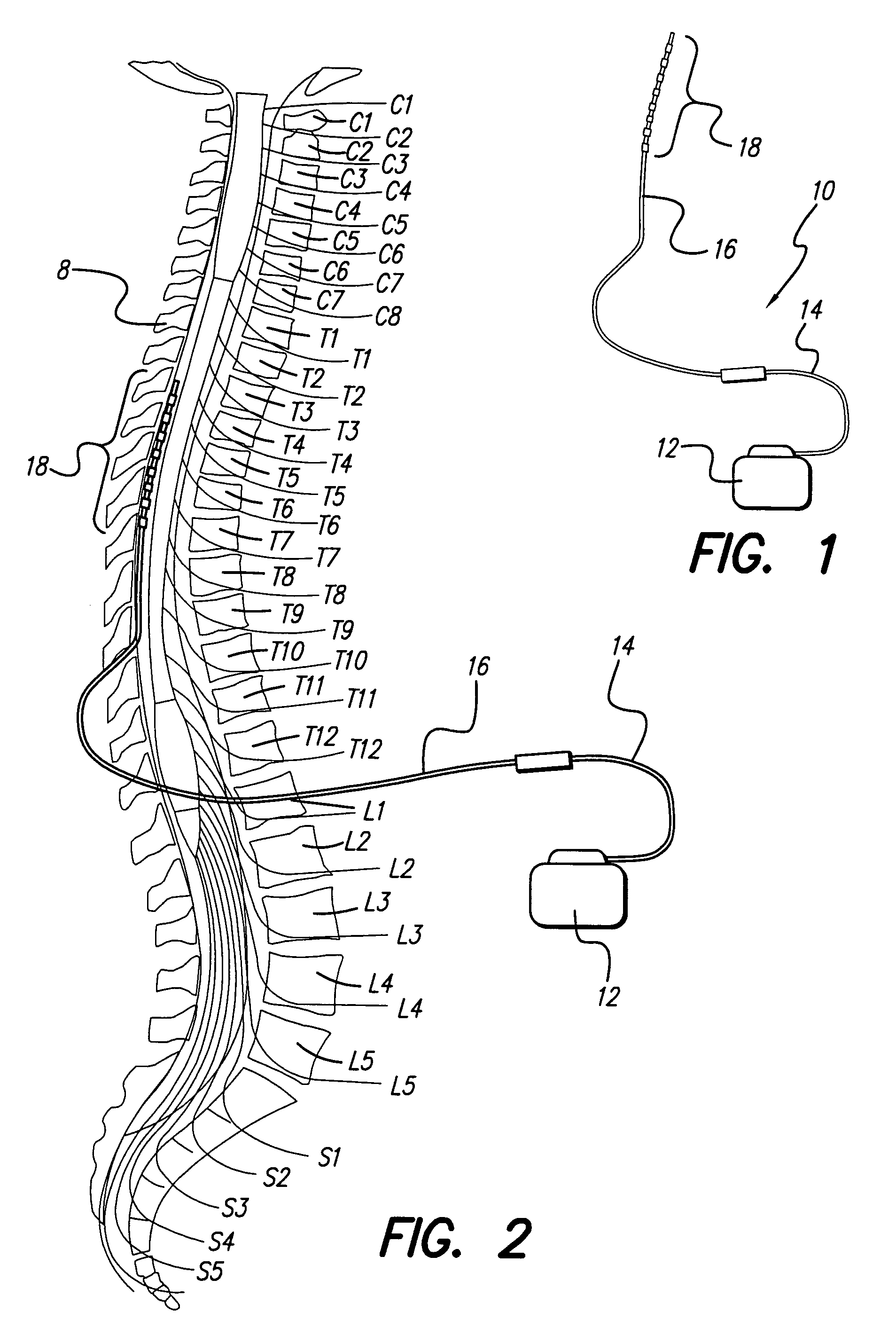 Power qualifier for electrical stimulation configurations