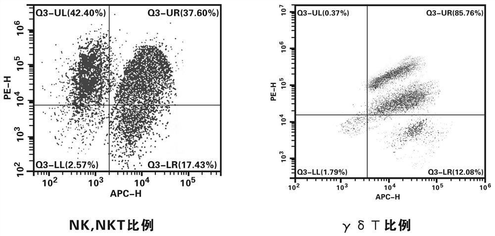 Preparation method of composite immune cell with high killing capability on tumor cells