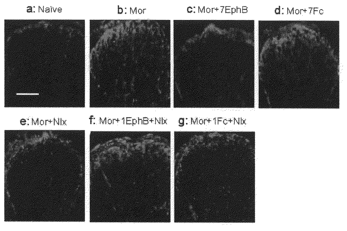 Method for preventing or treating opiate tolerance and dependence