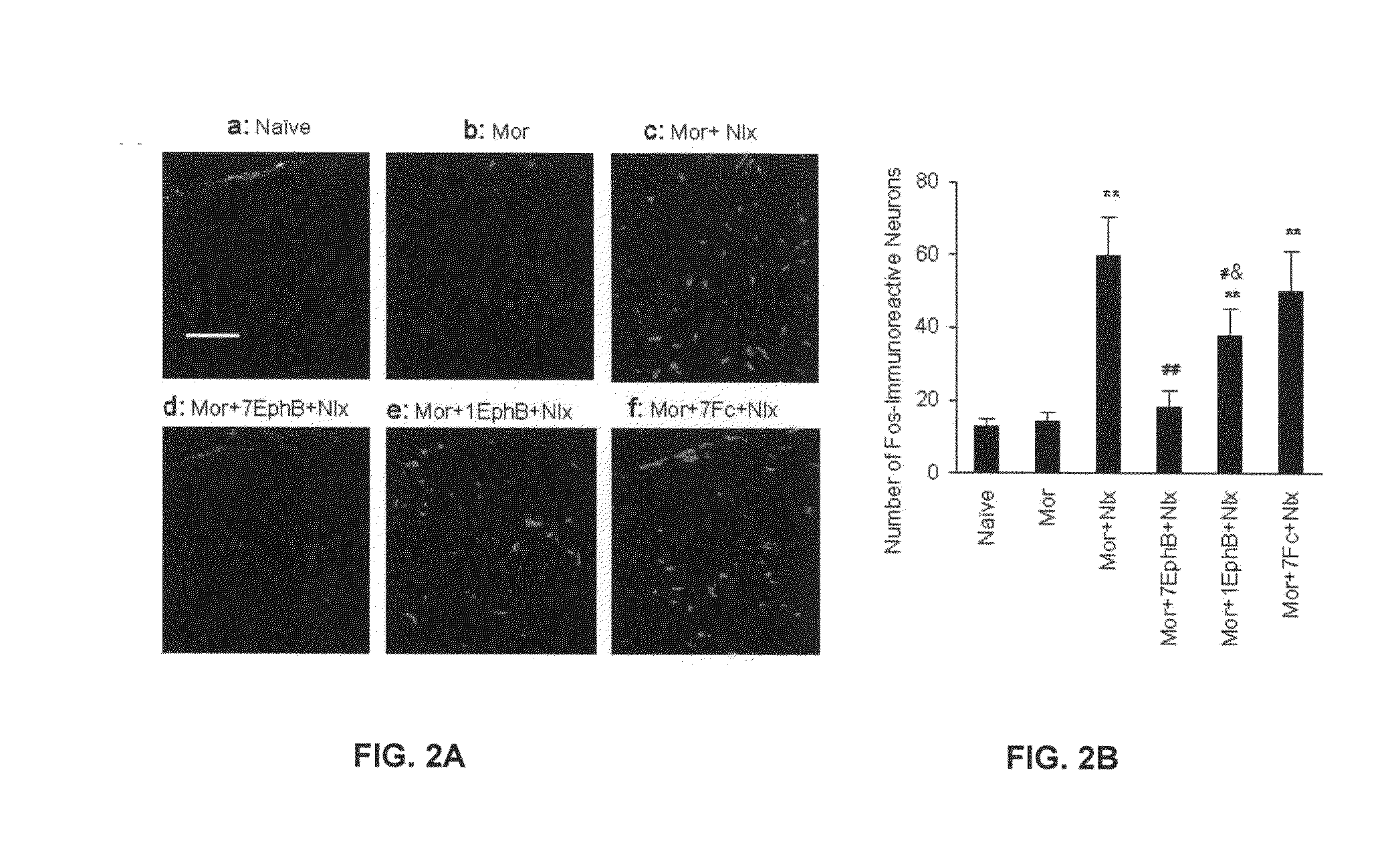 Method for preventing or treating opiate tolerance and dependence