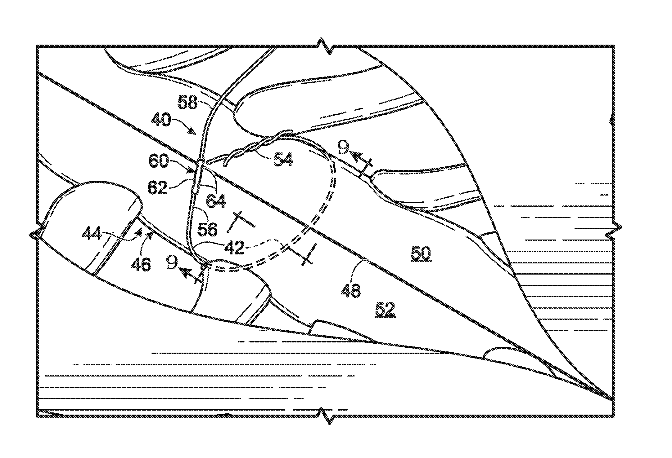 Replacement system for a surgical wire