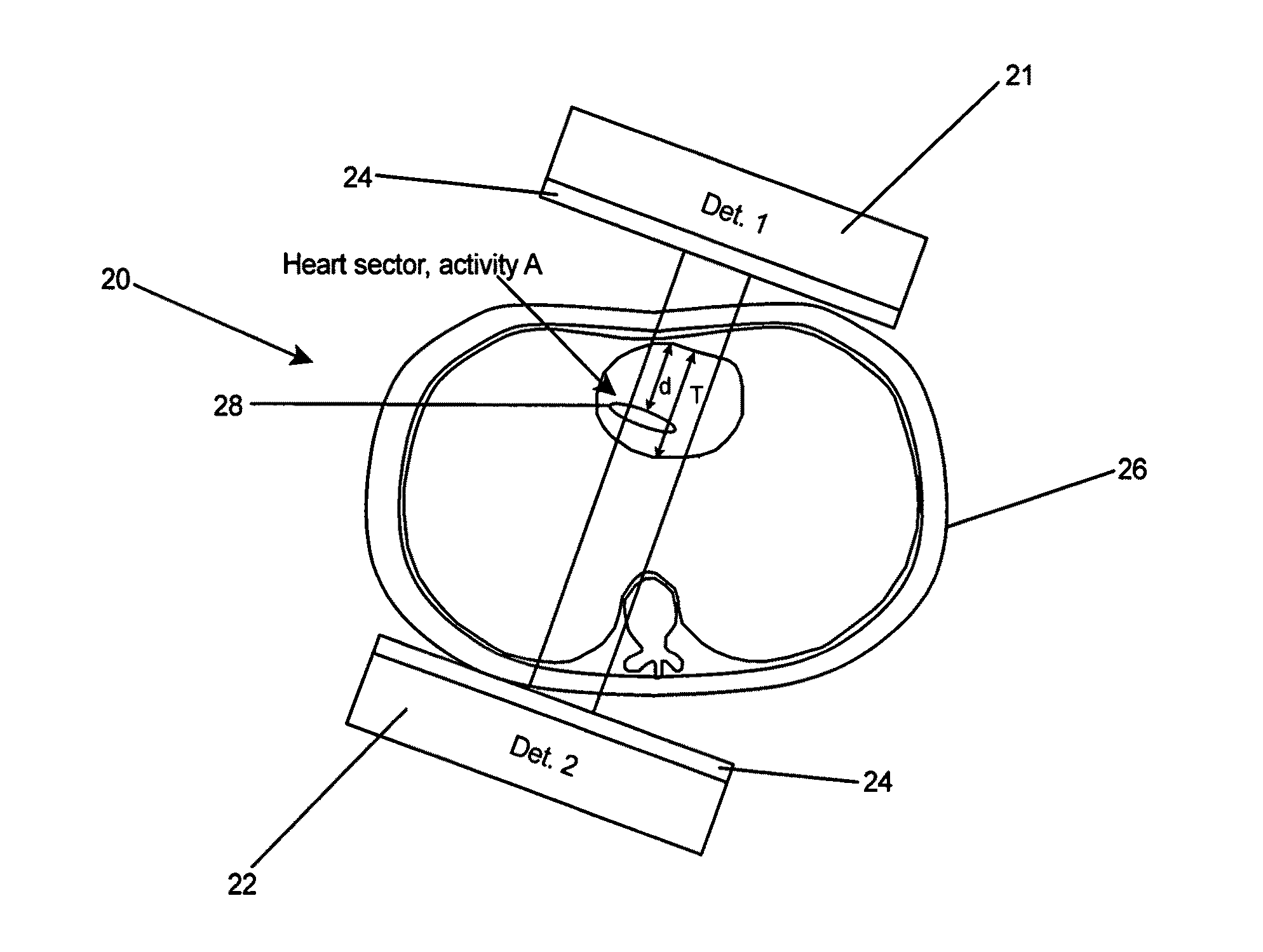 Imaging system for cardiac planar imaging using a dedicated dual-head gamma camera