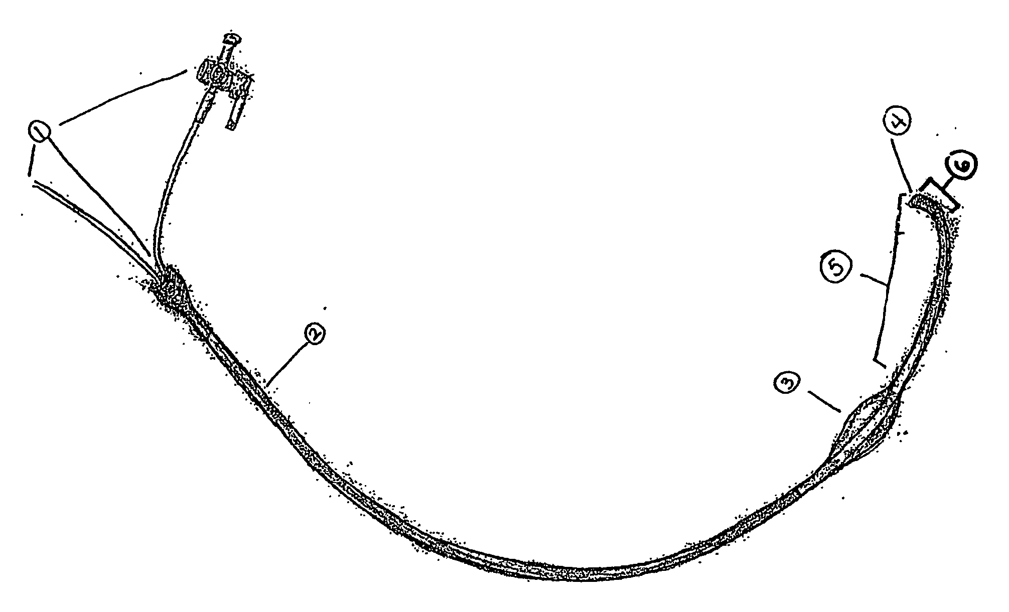 Intracardiac catheter and method of use