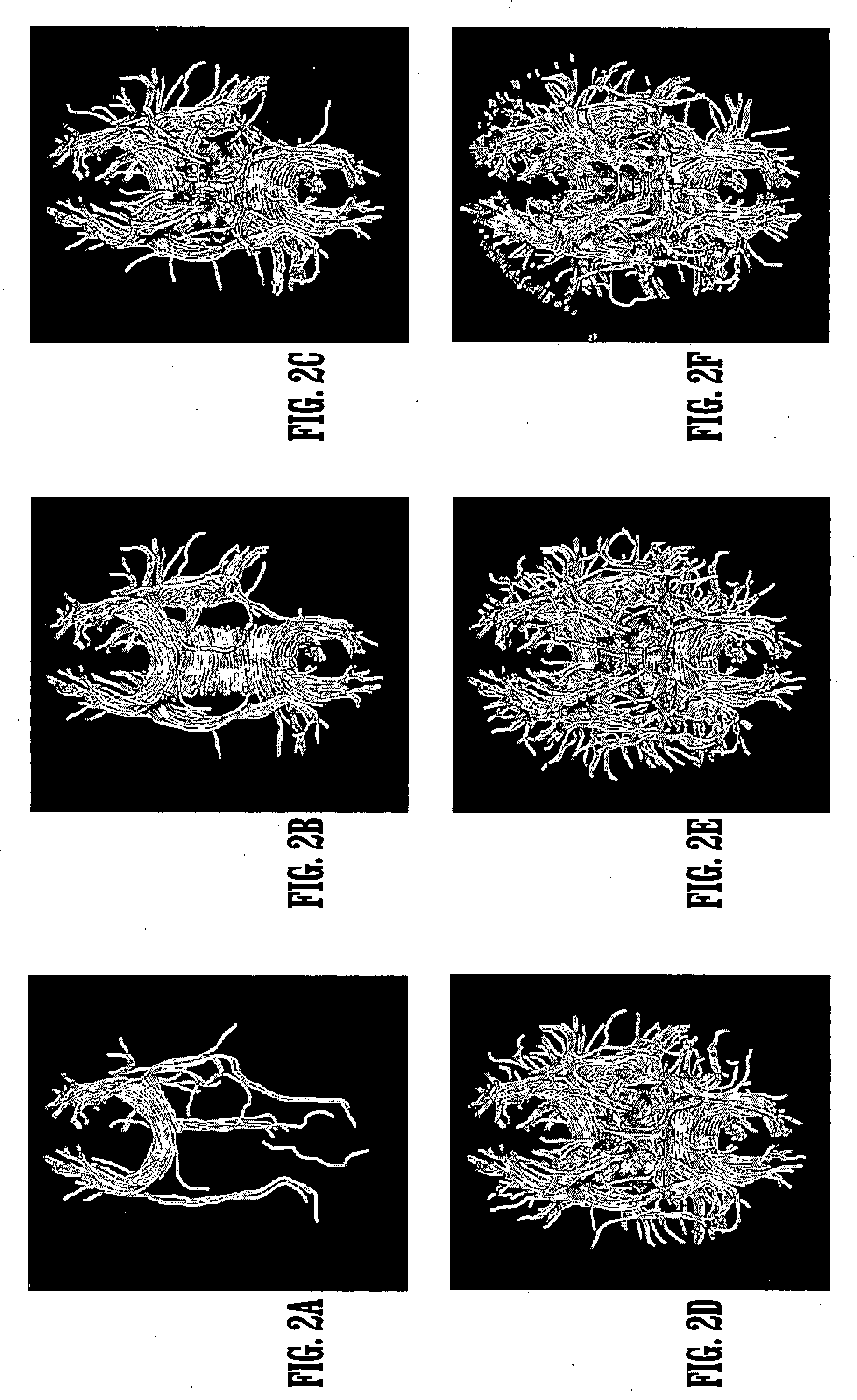 Detection of fiber pathways