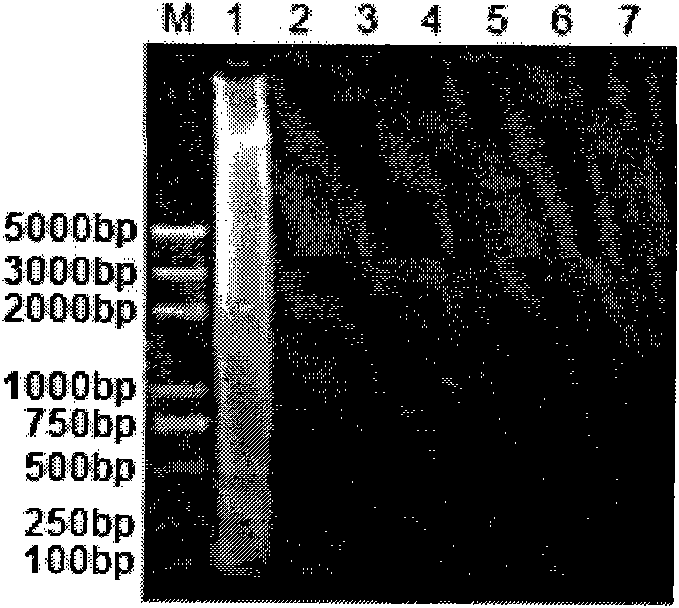 Loop-mediated isothermal amplification detection method of E. wenyoni