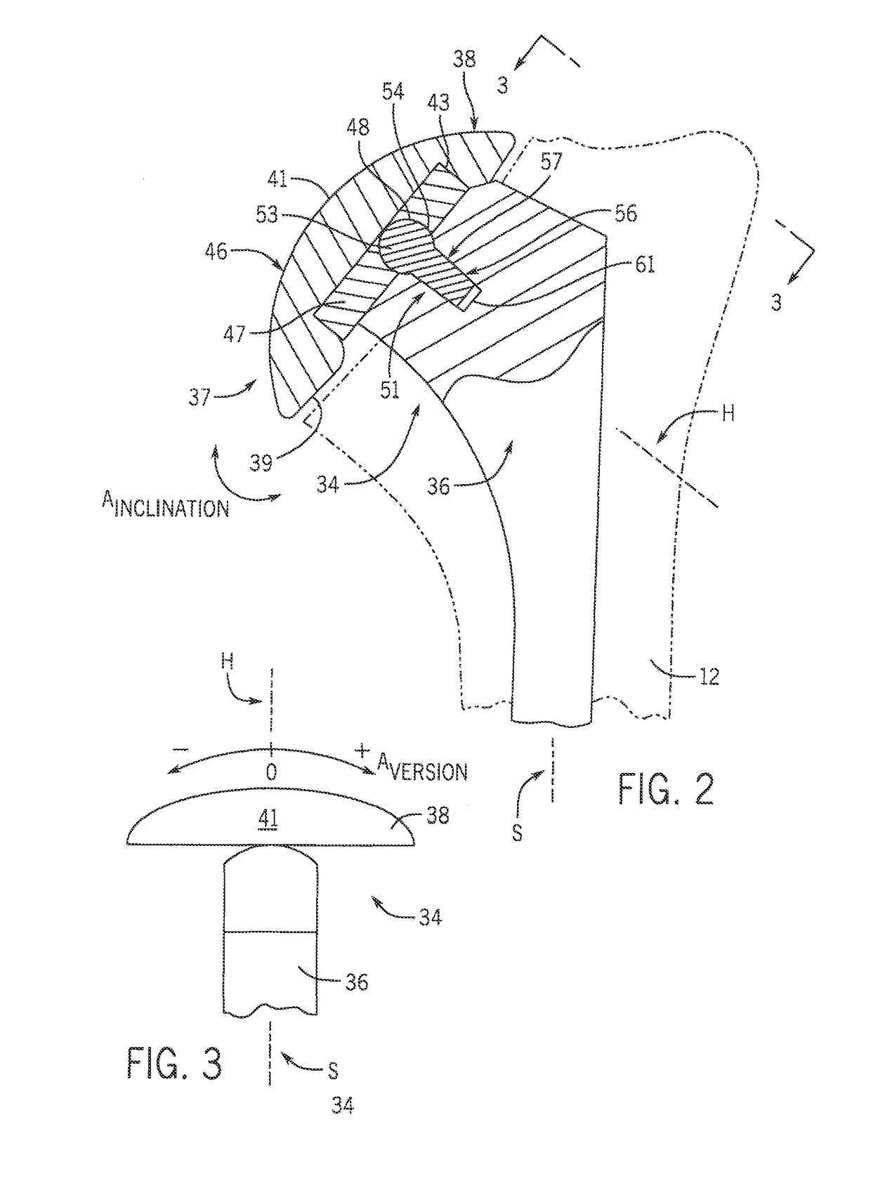 Shoulder prosthesis with variable inclination humeral head component