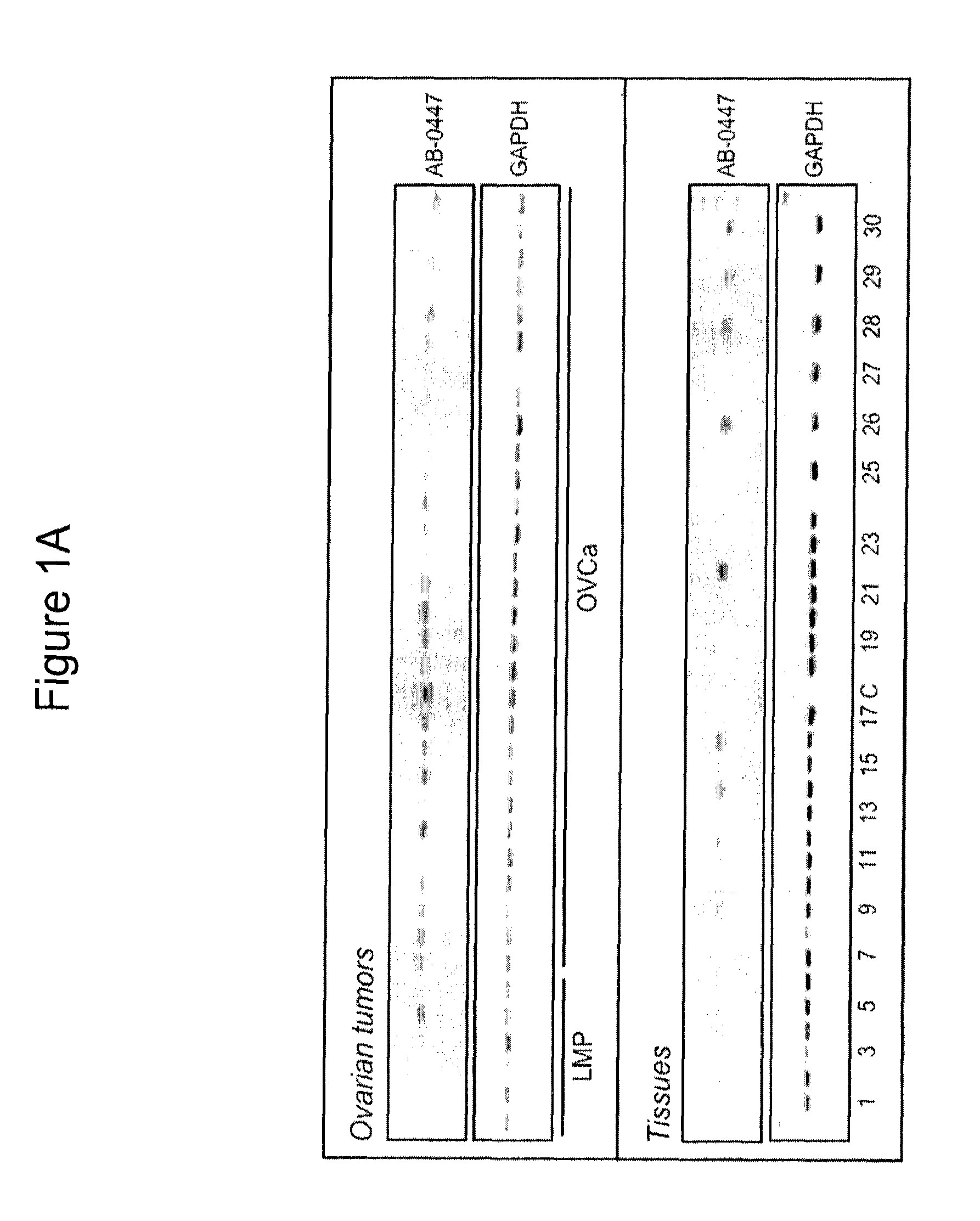 Antibodies that specifically block the biological activity of a tumor antigen