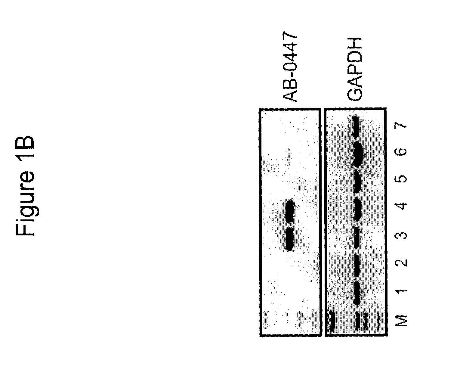 Antibodies that specifically block the biological activity of a tumor antigen