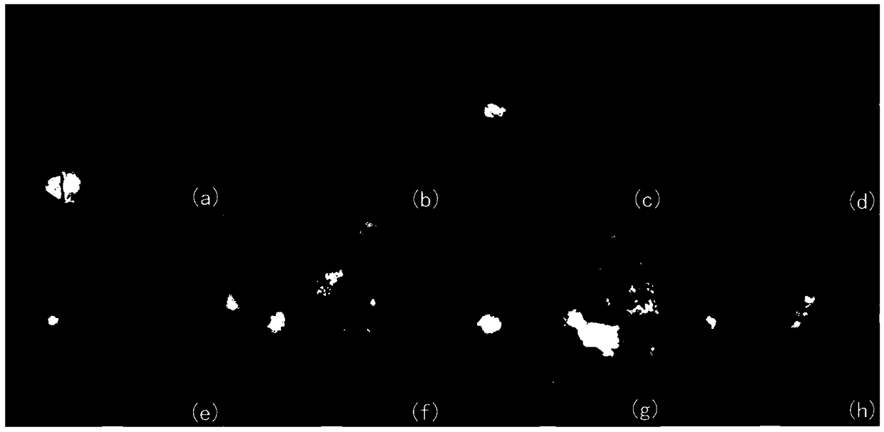 A method for locating fovea based on color retinal fundus image of lesion focus