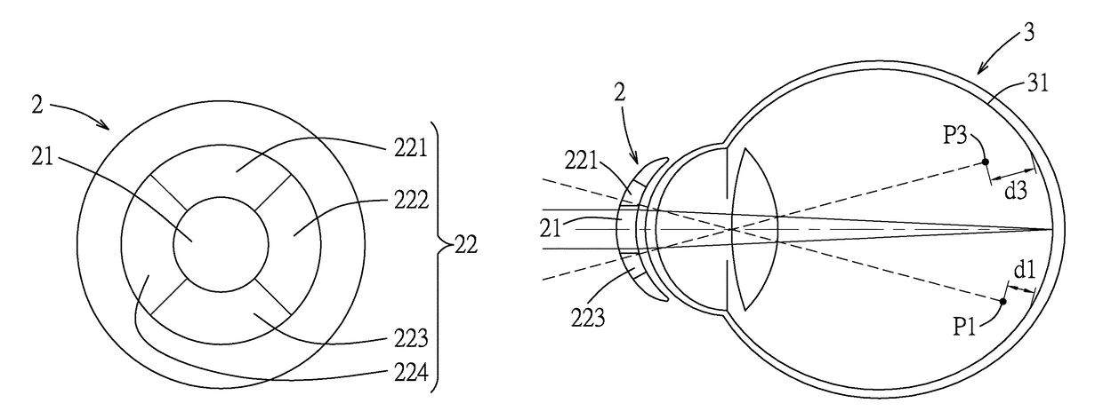 Lens and method for correcting vision of a user