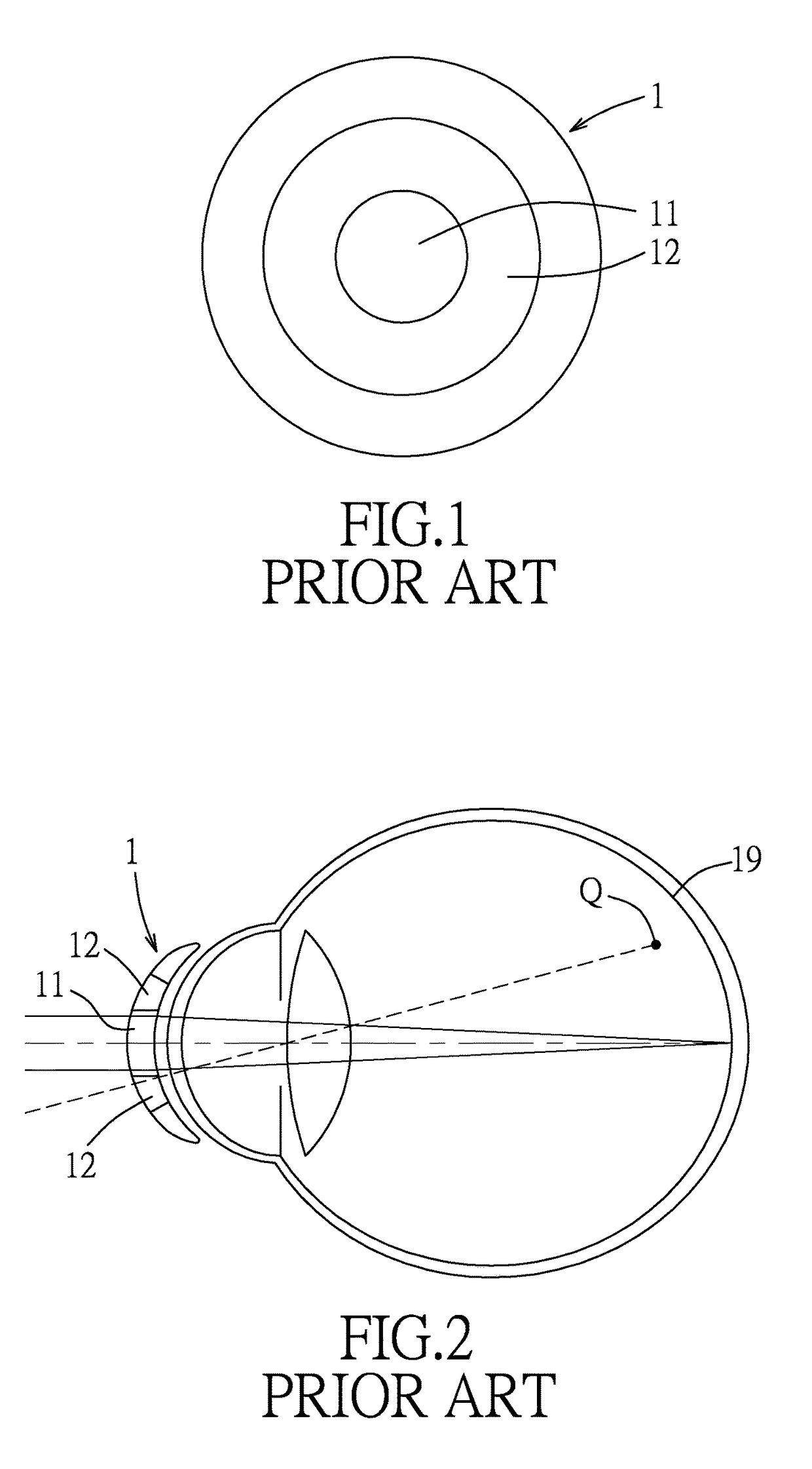 Lens and method for correcting vision of a user