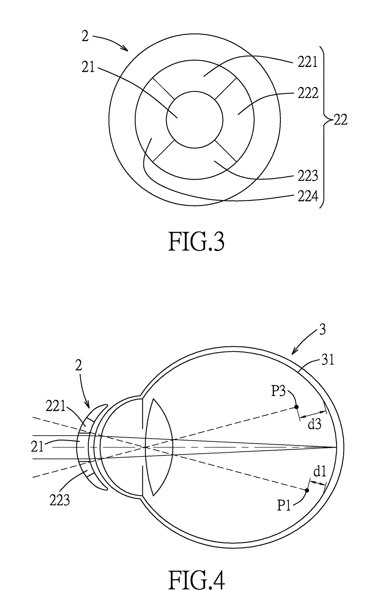 Lens and method for correcting vision of a user