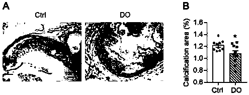 New application of dendrobium to preparation of product for preventing and treating angiosteosis