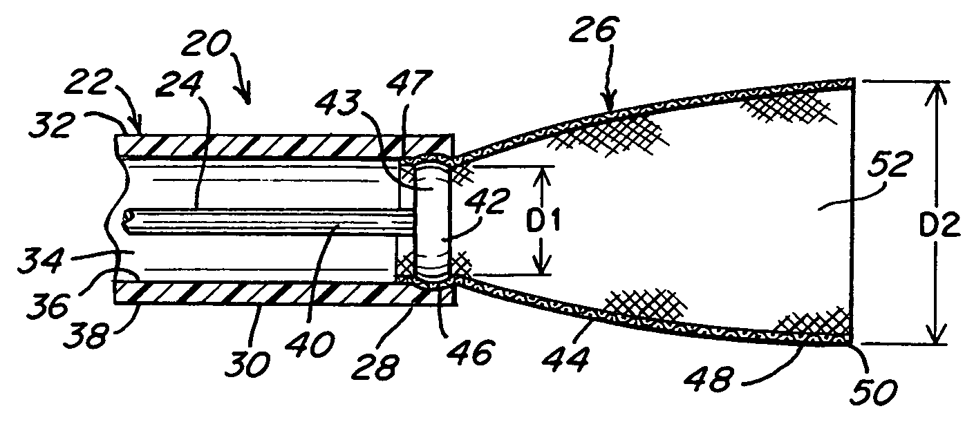 Everting stent and stent delivery system