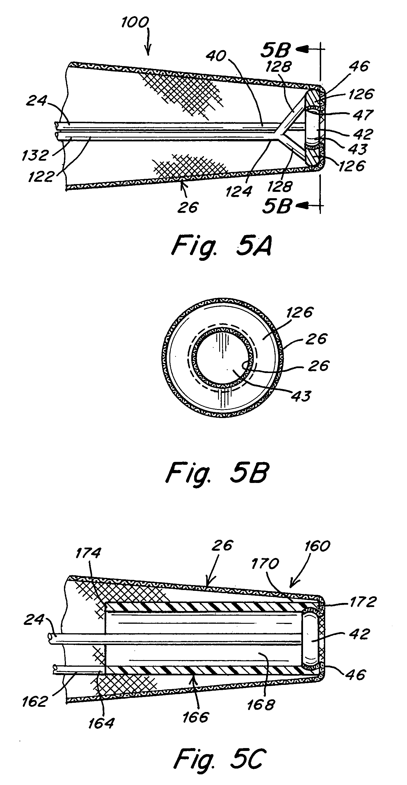 Everting stent and stent delivery system