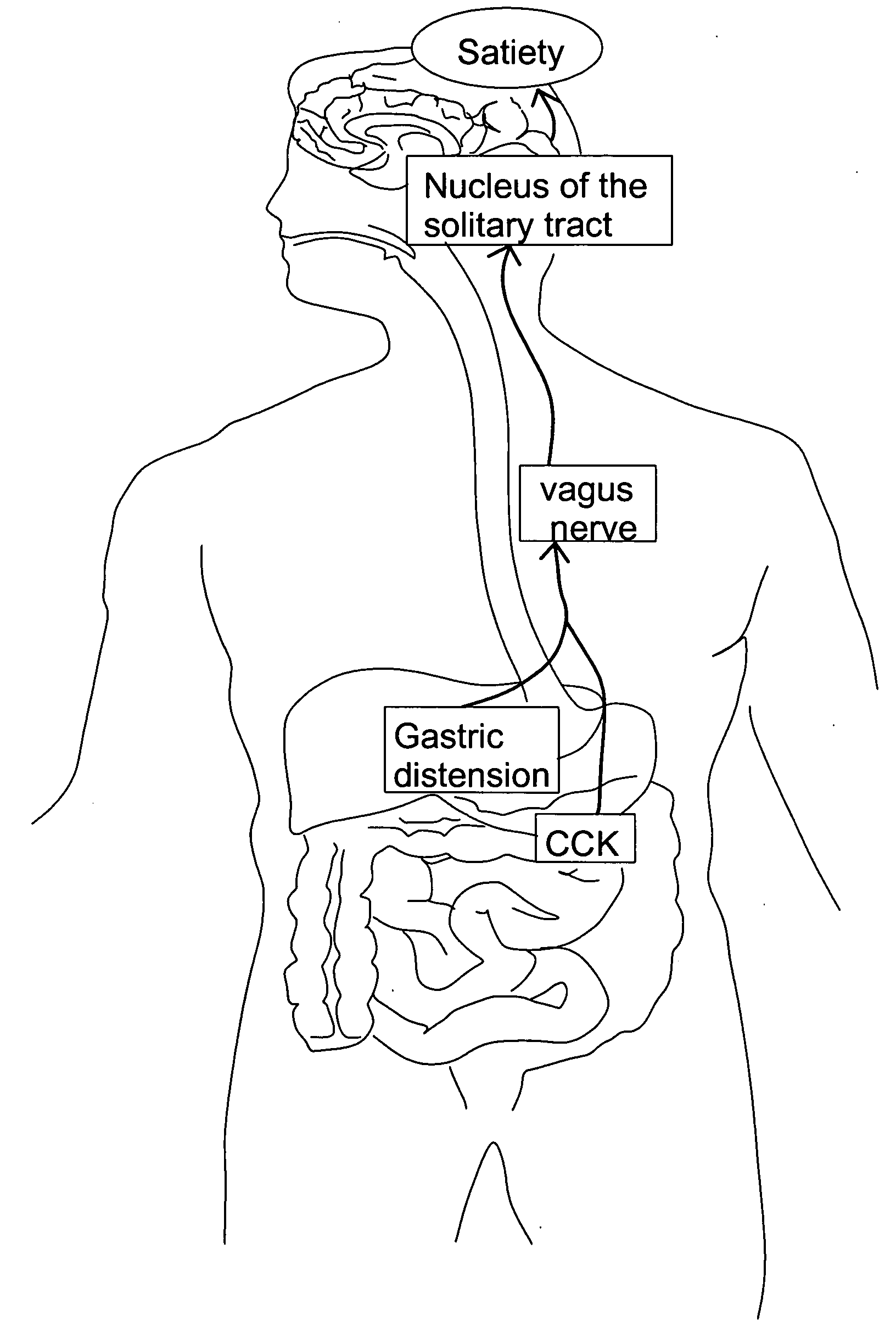 Method and system for vagal blocking and/or vagal stimulation to provide therapy for obesity and other gastrointestinal disorders
