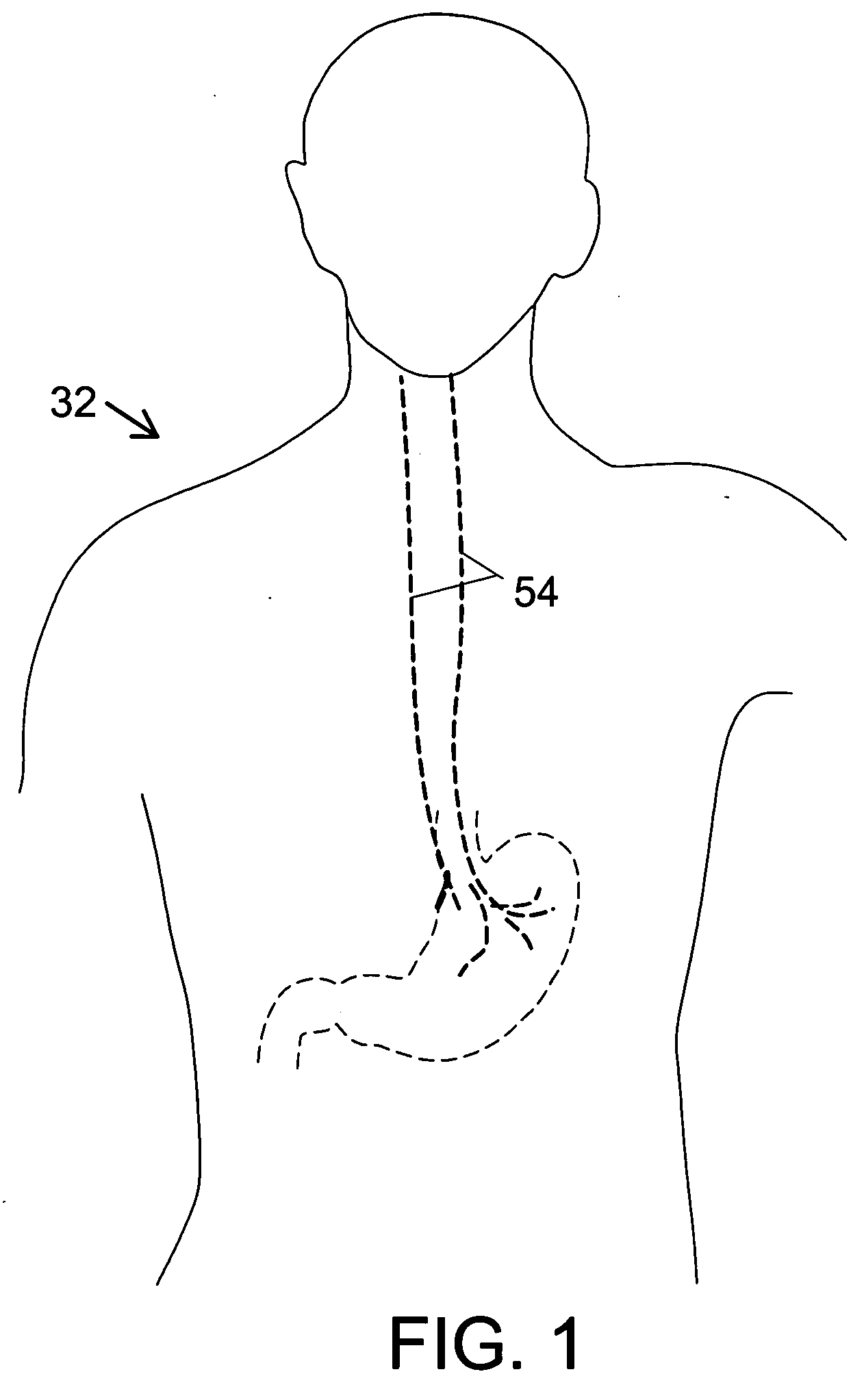 Method and system for vagal blocking and/or vagal stimulation to provide therapy for obesity and other gastrointestinal disorders