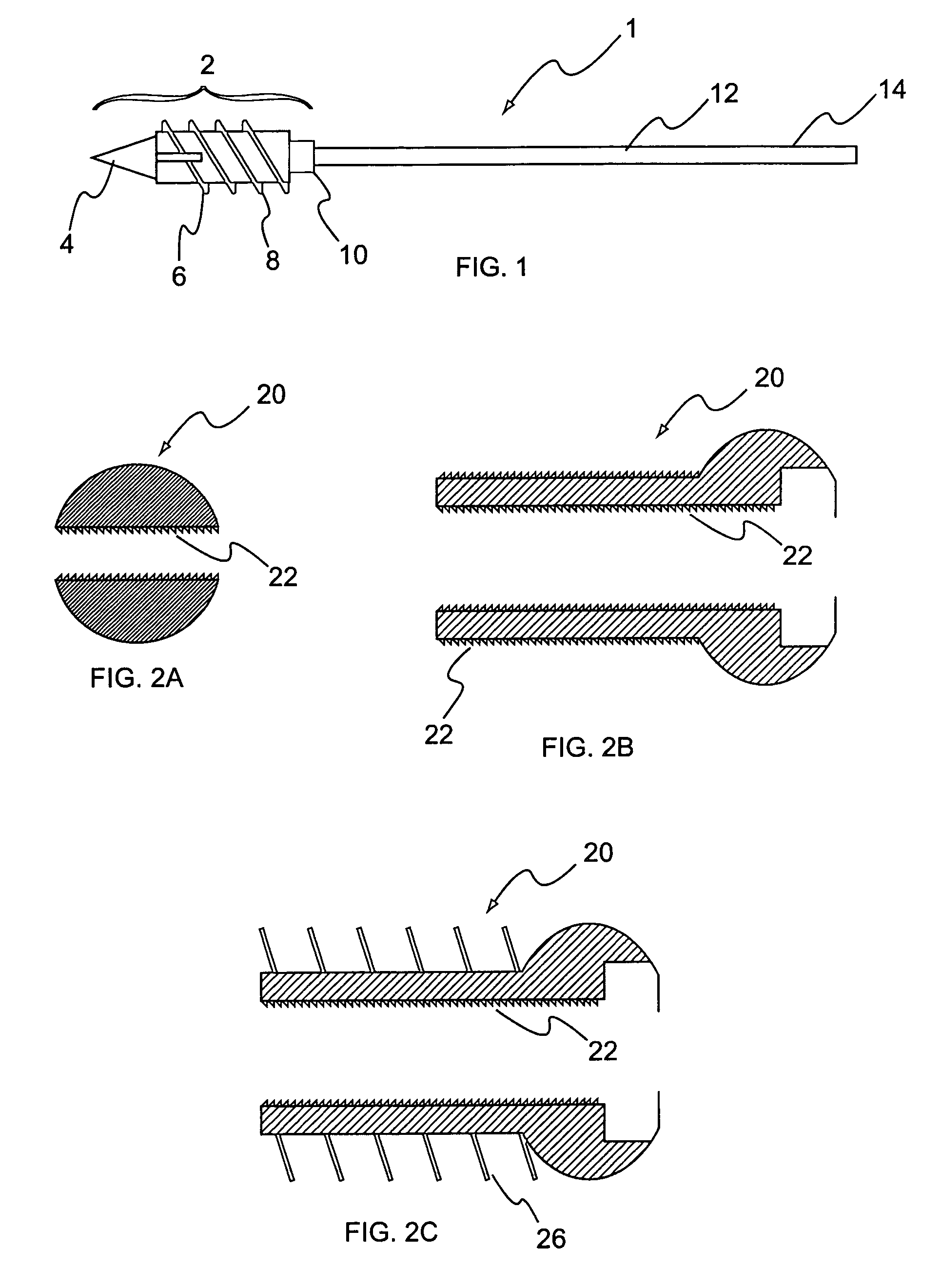 System and method for the fixation of bone fractures